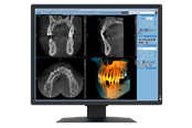 Skærm - 21" EIZO RadiForce MX217-SB - 1200x1600 - IPS - MX217-SB